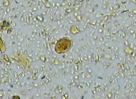 Cysta lamblii Giardia duodenalis
